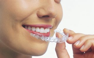 invisalign casablanca dr saile mohamed ali